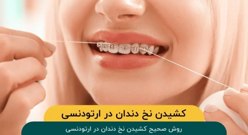 کشیدن-نخ-دندان-ارتودنسی